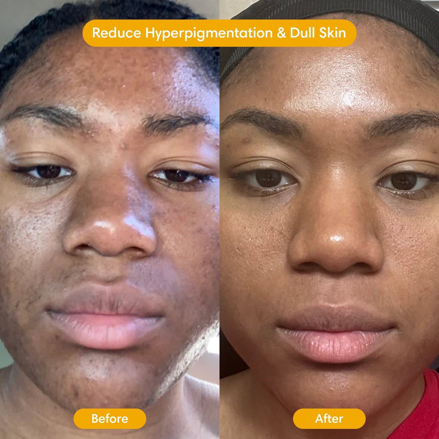 Turmeric Clay Mask