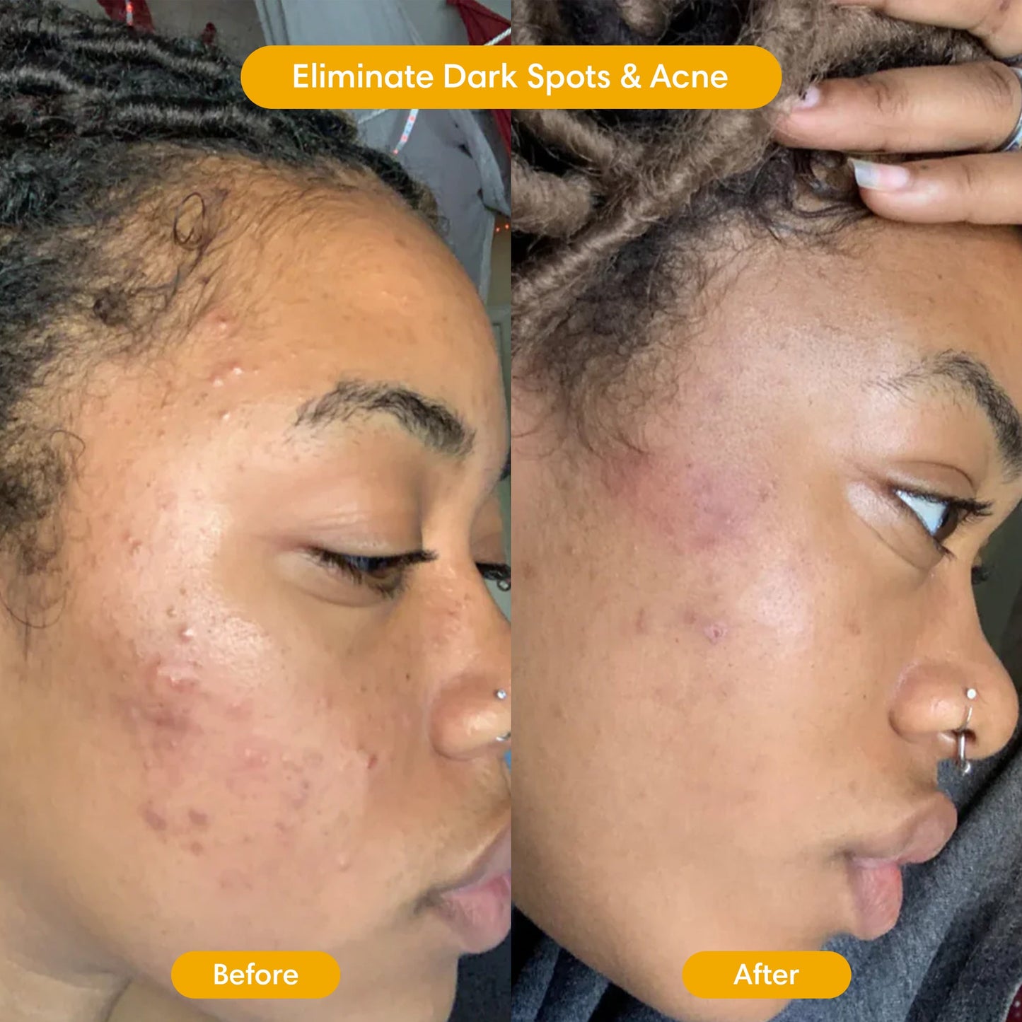 The Original Turmeric Brightening Bar