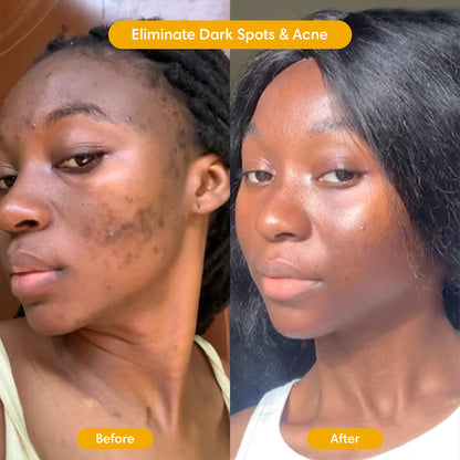 Turmeric Clay Mask
